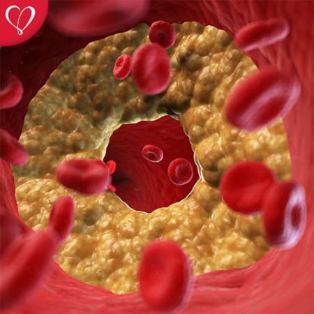 Dr Lorenzo Arce Best Cardiologist Tijuana